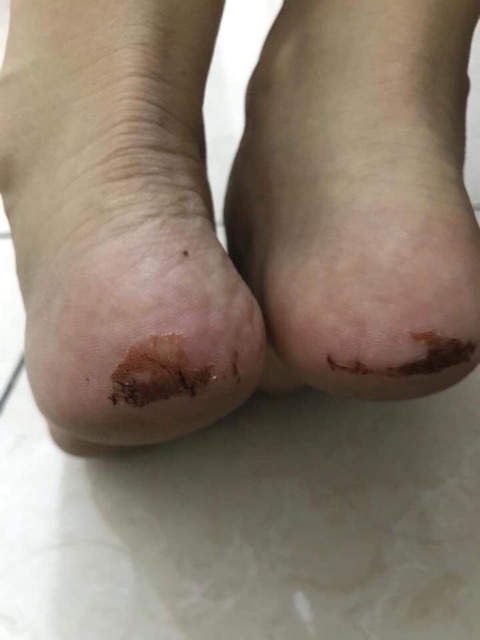 Bôi Nứt Gót Chân kiểu gì cũng hết nứt | BigBuy360 - bigbuy360.vn