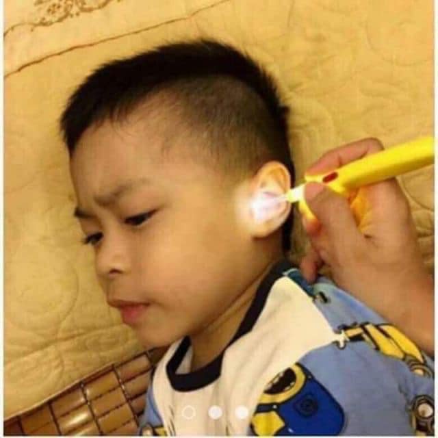 Lấy ráy tai có đèn cho bé 3 đầu