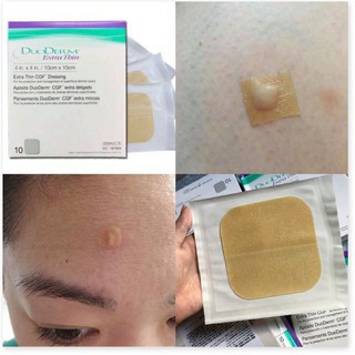 [Mã giảm giá mỹ phẩm chính hãng] Miếng Dán Mụn Duoderm Extra (1 miếng)