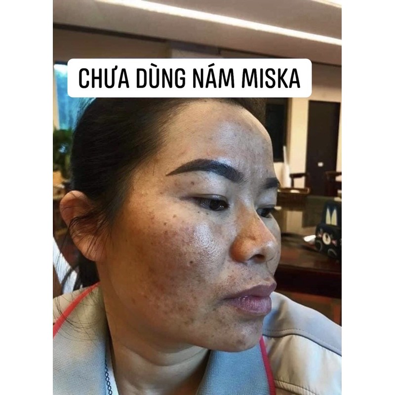 Kem Nám Cao Cấp Miska