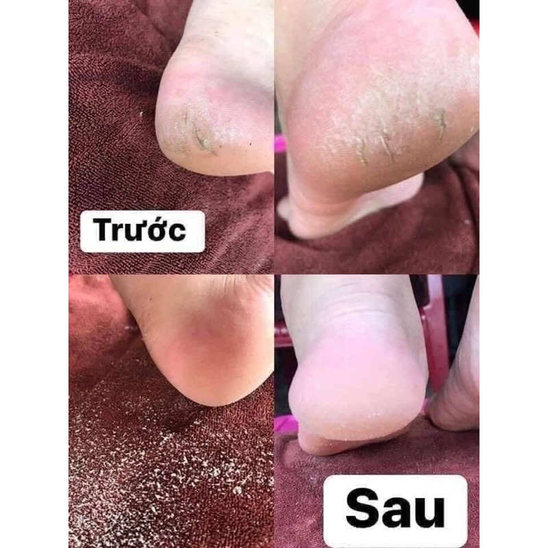 Máy chà gót chân, làm mịn màng gót chân, máy mài gót chân nail