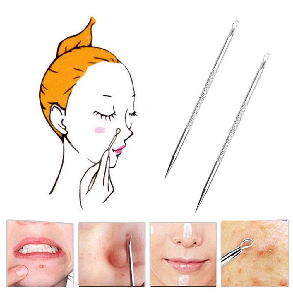 Set 5 Dụng Cụ Nặn Mụn Chuyên Dụng