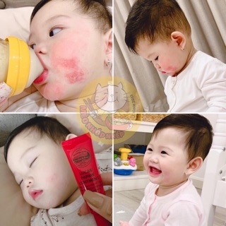 Dưỡng môi Lucas