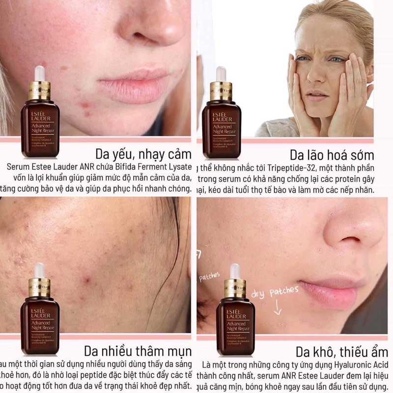 SERUM THẦN THÁNH ESTEE LAUDER ADVANCED NIGHT REPAIR
