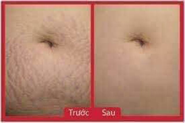 Mỡ trăn nguyên chất dạng hũ | BigBuy360 - bigbuy360.vn