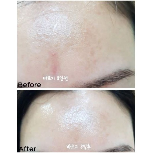 Tinh Chất Vitamin C Nguyên Chất Dưỡng Trắng Mờ Thâm Sạm Vari:Hope 8 Days Pure Vitamin C Ampoule Plus 15g | BigBuy360 - bigbuy360.vn