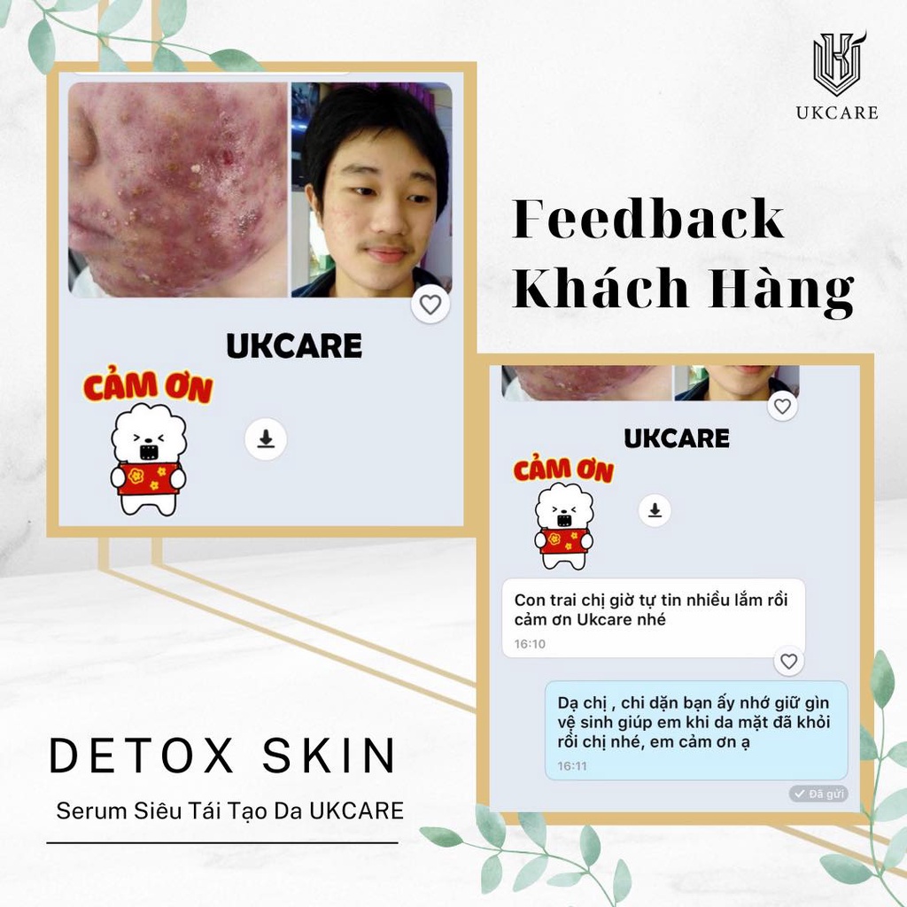 DETOX SKIN – SẠCH MỤN, SẠCH KHUẨN UKCARE | BigBuy360 - bigbuy360.vn