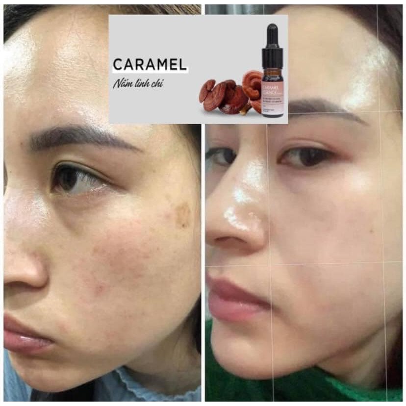 Serum Caramel Esence Nhật Bản chuẩn ( Có check mã cod) mua 3 tặng 1 | BigBuy360 - bigbuy360.vn