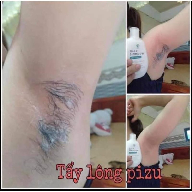 tẩy lông Hair Removal pizu công nghệ hàn quốc