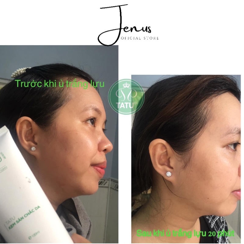 Kem Ủ Trắng Săn Chắc Da dành cho da mặt và toàn thân