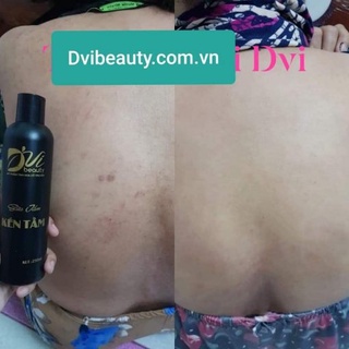 Sữa Tắm Kén Tằm DVi nature