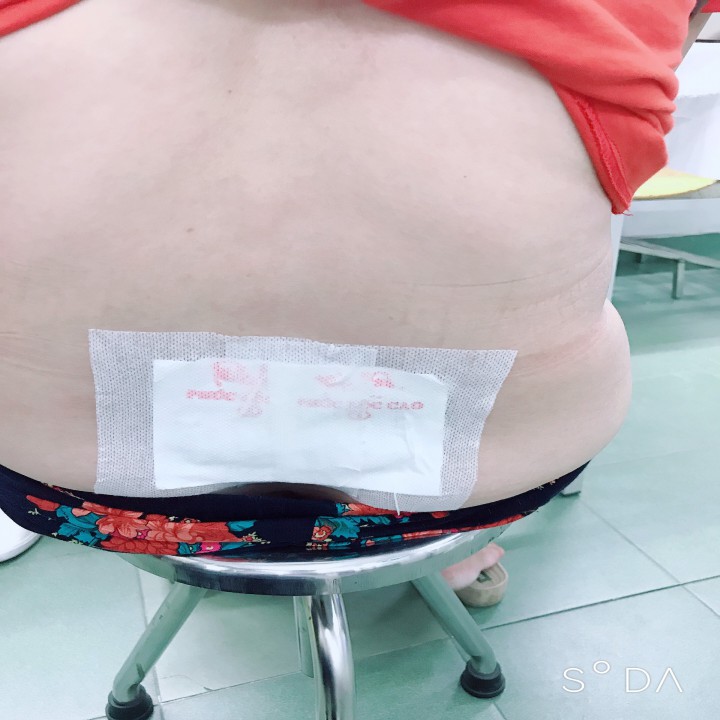 Cao dán xương khớp PHÚC LỘC