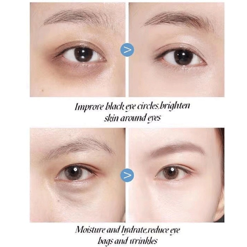 Mặt nạ mắt dạng thạch collagen giảm quầng thâm bọng mắt chống nếp nhăn dưỡng ẩm chăm sóc da | BigBuy360 - bigbuy360.vn