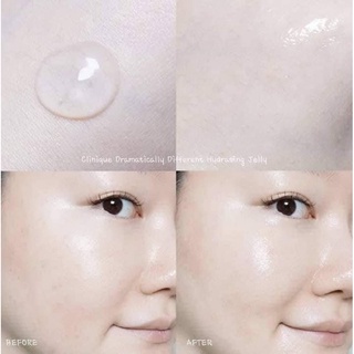 Serum tế bào gốc MAXCLINIC