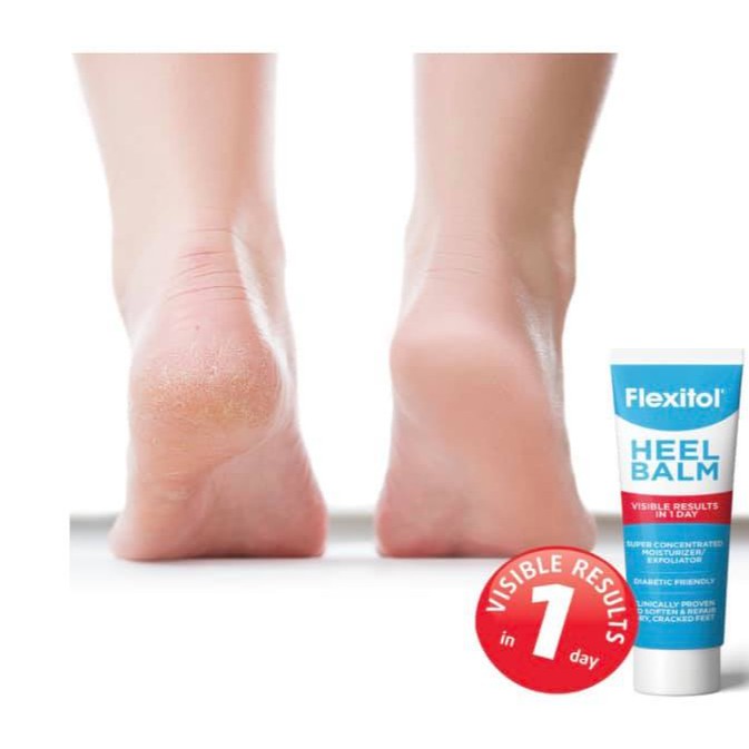 [Hàng Mỹ] Kem hỗ trợ giảm Nứt gót chân Flexitol Heel Balm tuýp 56g