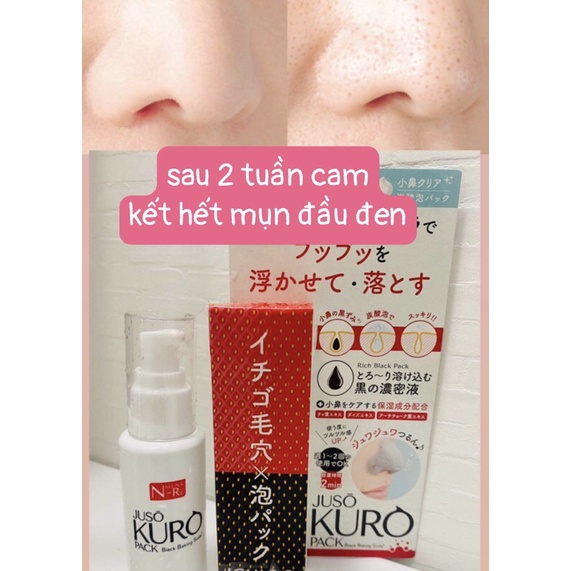 Xịt mụn đầu đen Soda Nhật bản 50g