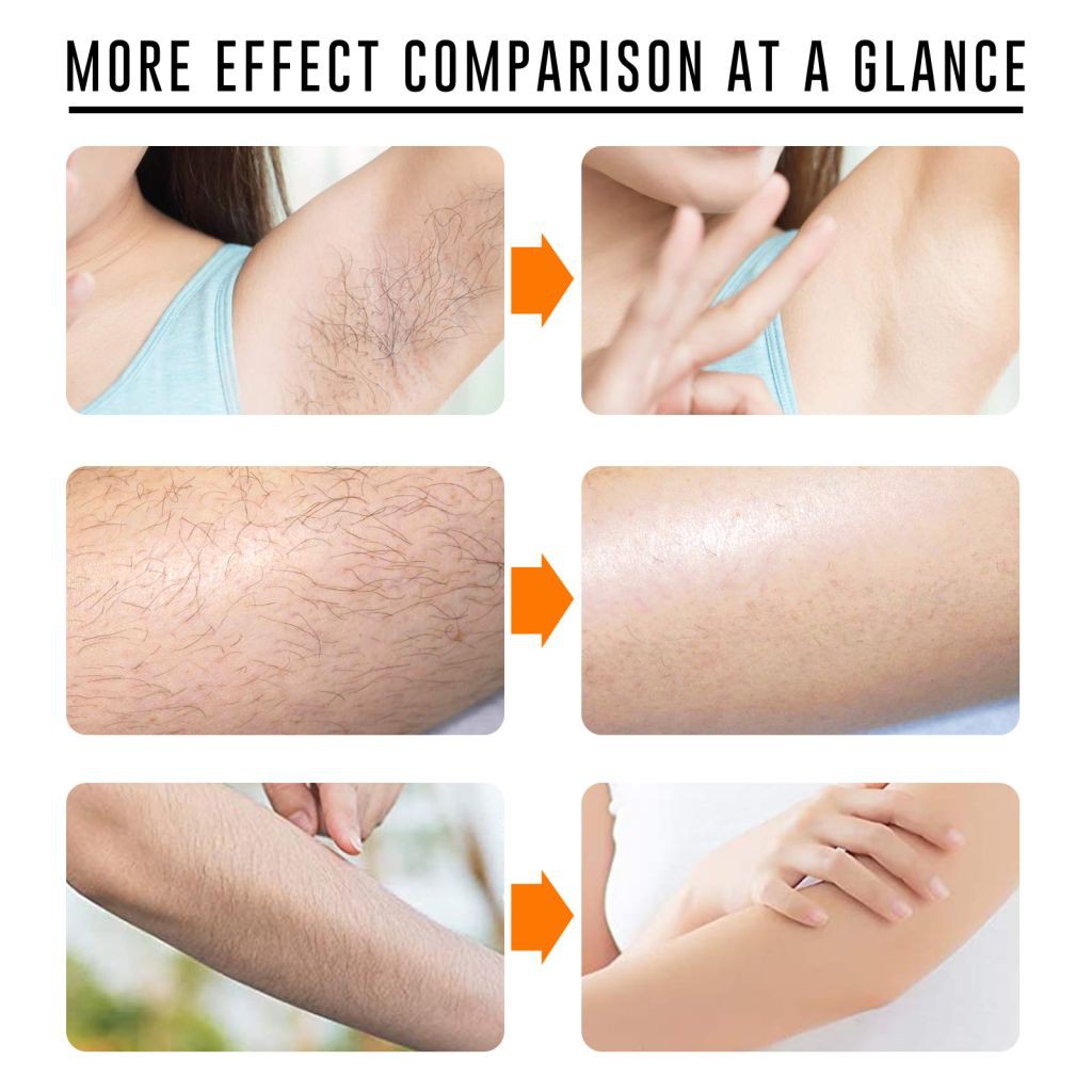 (Hàng Mới Về) Kem Tẩy Lông Dạng Xịt Kích Thước Nhỏ Gọn Tiện Dụng | BigBuy360 - bigbuy360.vn