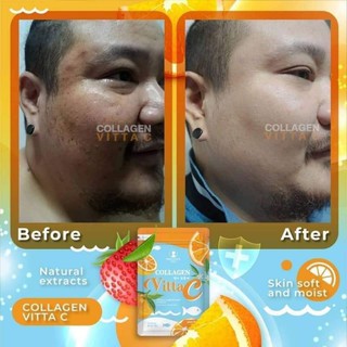 Túi 60v Collagen Vitta C Thái Lan
