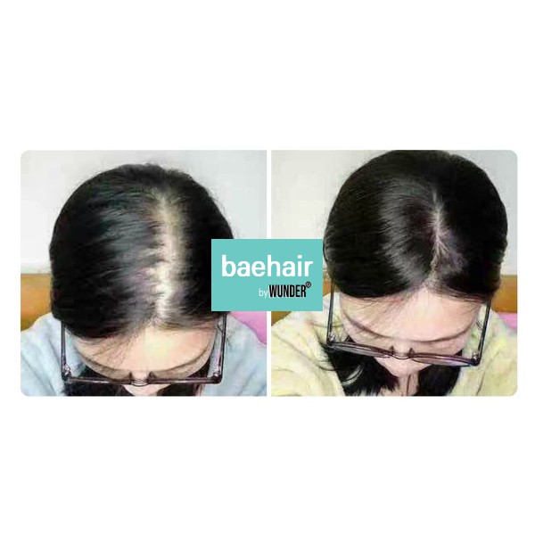 Xịt dưỡng làm dày ngăn ngừa rụng tóc Baehair Super Volume | BigBuy360 - bigbuy360.vn