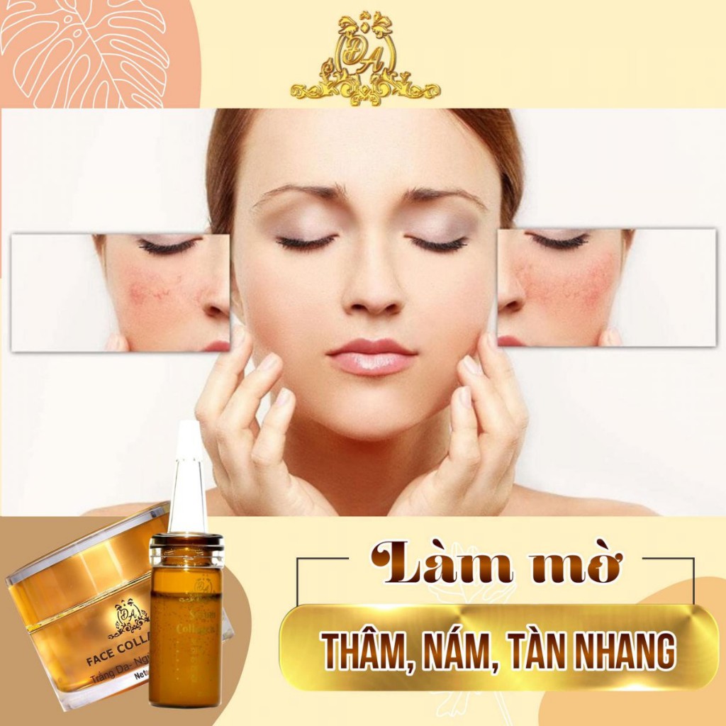 Kem Face Collagen X3 Trắng Da Ngừa Nám Mụn Se Khít Lỗ Chân Lông