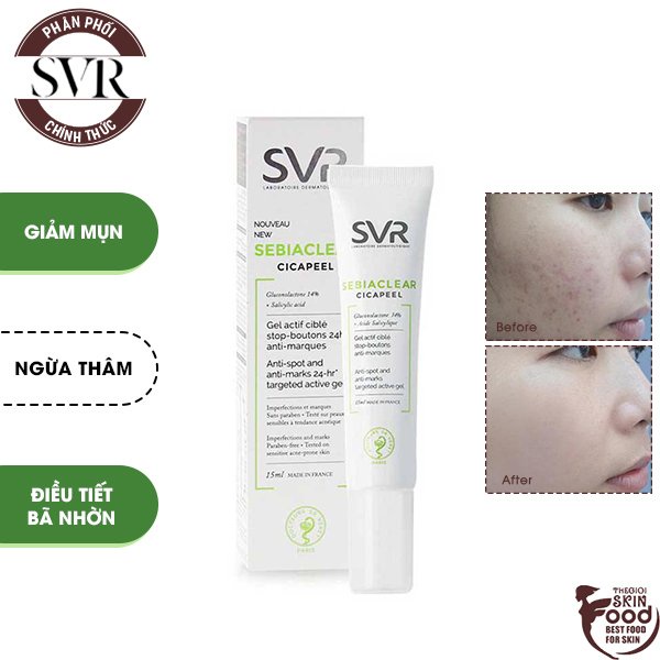 Kem Chấm Mụn Dạng Gel SVR Sebiaclear Cicapeel 15ml