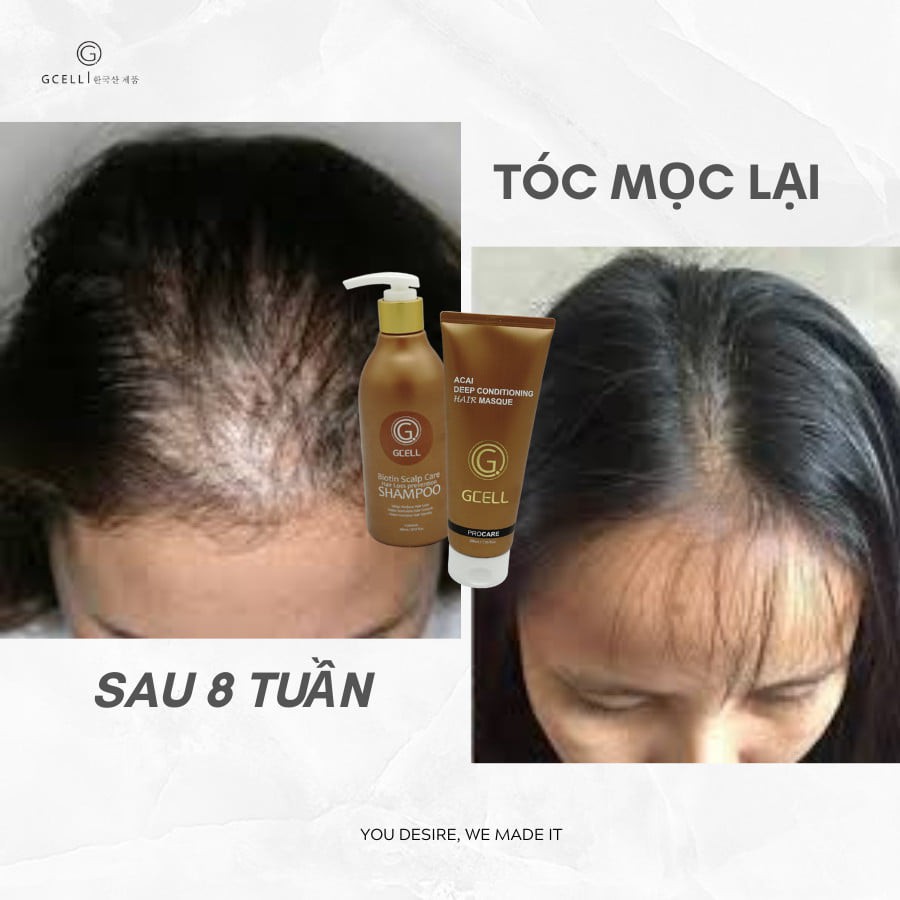 Dầu Gội ngăn rụng tóc - Dầu Xả phục hồi lõi tóc Gcell Chính Hãng Hàn Quốc | BigBuy360 - bigbuy360.vn