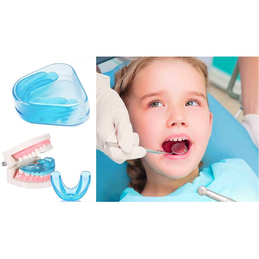 Máng định hướng răng Trainer 3 tác dụng , định hướng không cho răng mọc lệch, chống ngáy , chống nghiến răng