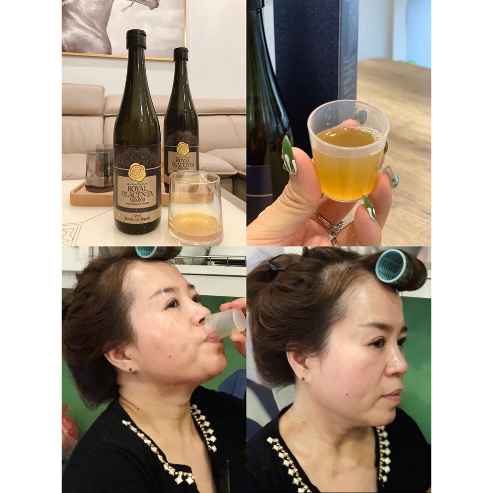 Nước nhau thai ROYAL PLACENTA 500000mg Nhật bản 720ml | BigBuy360 - bigbuy360.vn