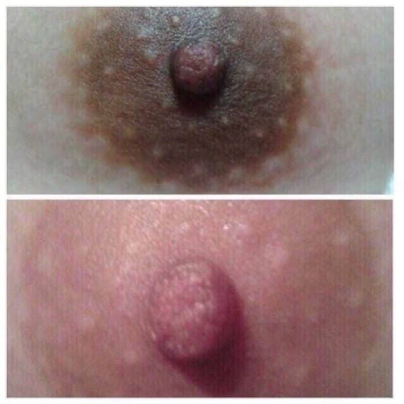 Peel hồng ti,nách, bikini TCA USA | BigBuy360 - bigbuy360.vn