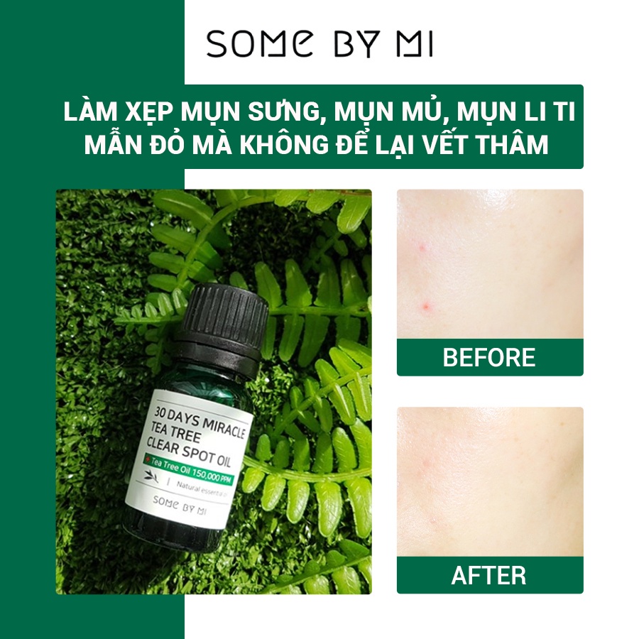 Hàng Công ty Tinh Dầu Tràm Trà Thần Kỳ Some By Mi 30 Days Miracle Tea Tree Clear Spot Oil 10ml