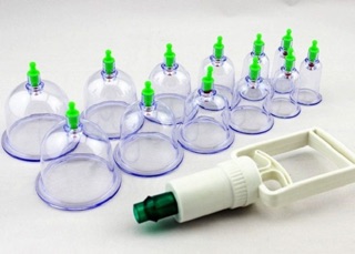 Bộ giác hơi không dùng lửa
