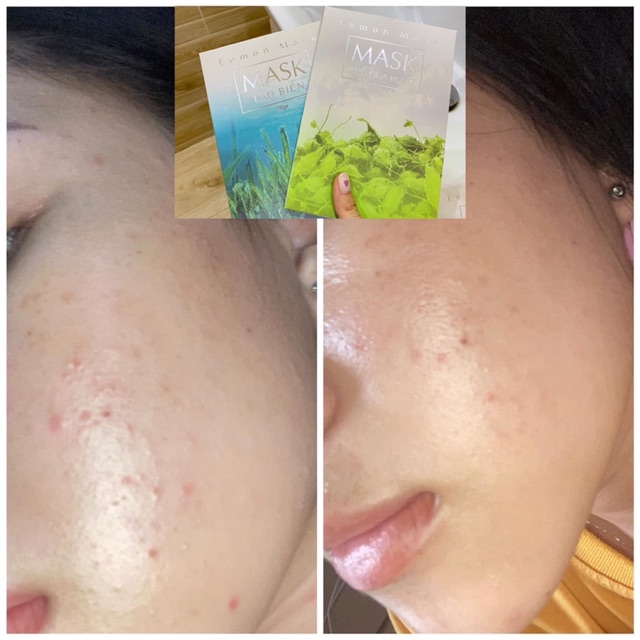 Lemonmask (mask khổ qua rừng và mask tảo biển)