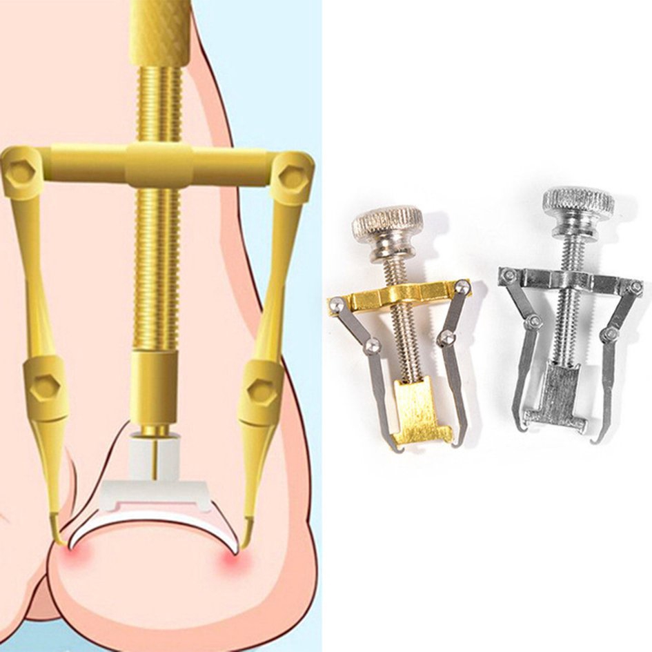 Dụng cụ chỉnh hình móng chân quặp chuyên dụng tiện lợi