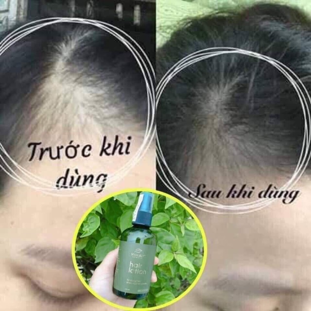 Tinh dầu bưởi Vijully Hair Lotion, ngăn rụng giúp mọc tóc hiệu quả (hàng công ty)