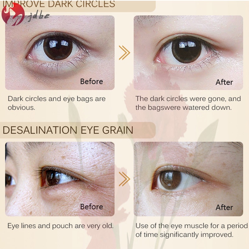 Kem dưỡng ẩm chống lão hóa loại bỏ nếp nhăn và bọng mắt
 | BigBuy360 - bigbuy360.vn