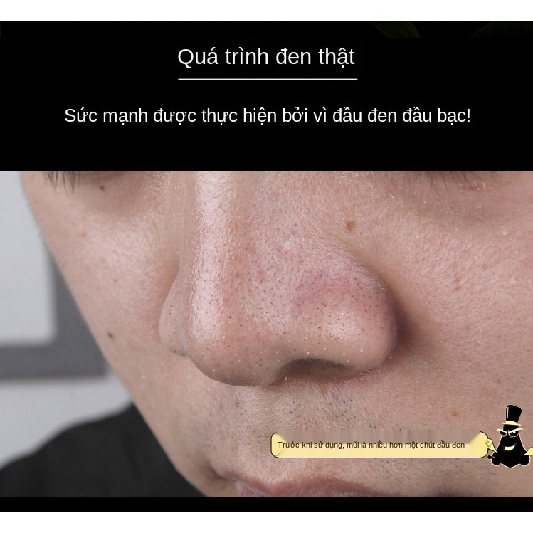 [Hàng mới về] Mặt Nạ Bùn Khoáng Lột Mụn Đầu Đen Cho Vùng Mũi