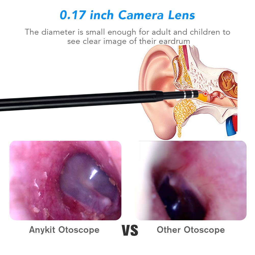 Y Tế Trong Vệ Sinh Tai Camera Nội Soi Thìa Camera Mini Tai Chọn Lấy Ráy Tai Loại Bỏ Hình Ảnh Tai Miệng Mũi Otoscope Hỗ Trợ Android máy Tính