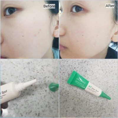 Kem chấm mụn AC Clear Spot 10ml | BigBuy360 - bigbuy360.vn