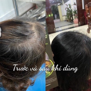 Tinh chất làm đen tóc thảo mộc - phủ bạc Mẹ Ken