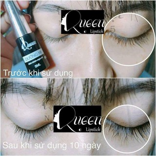 COMBO DƯỠNG DÀI MI + MASCARA + BẤM MI QUEEN