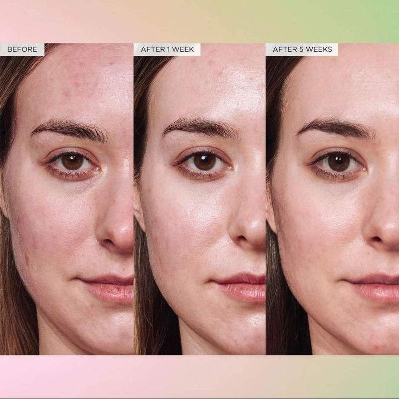 Tinh chất bơ dưỡng da Glow Recipe Avocado Soothing Skin Barrier Serum with Ceramides
