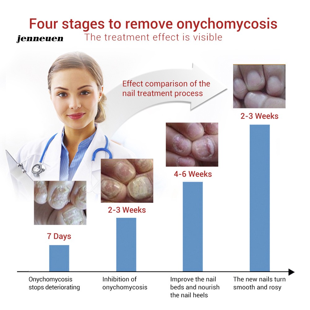 [Hàng mới về] Tinh chất phục hồi móng tay chống nấm 15ml | BigBuy360 - bigbuy360.vn