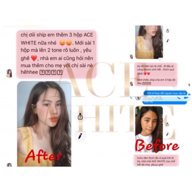 Viên uống trắng da Collagen nhập khẩu Mỹ Ace White | Thế Giới Skin Care