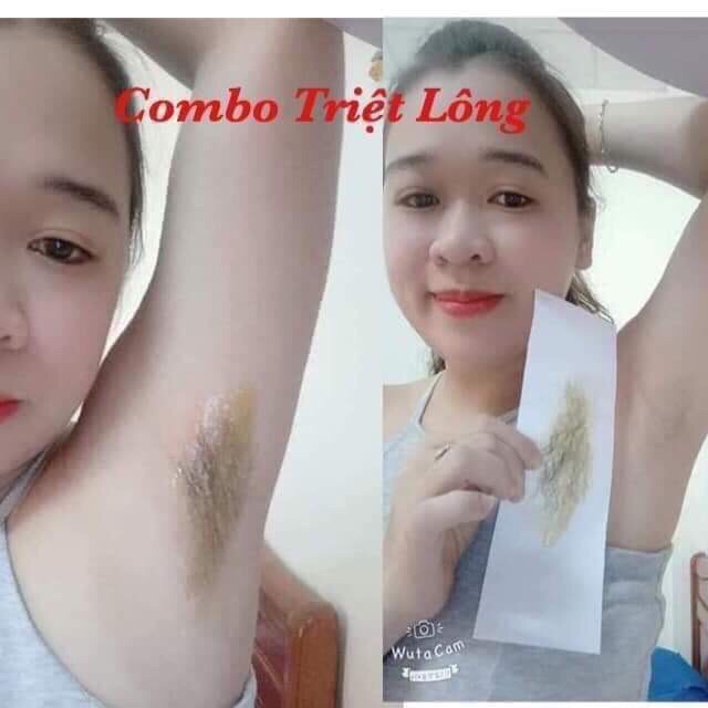 Combo 2 Wax lông tại nhà Tiện lợi