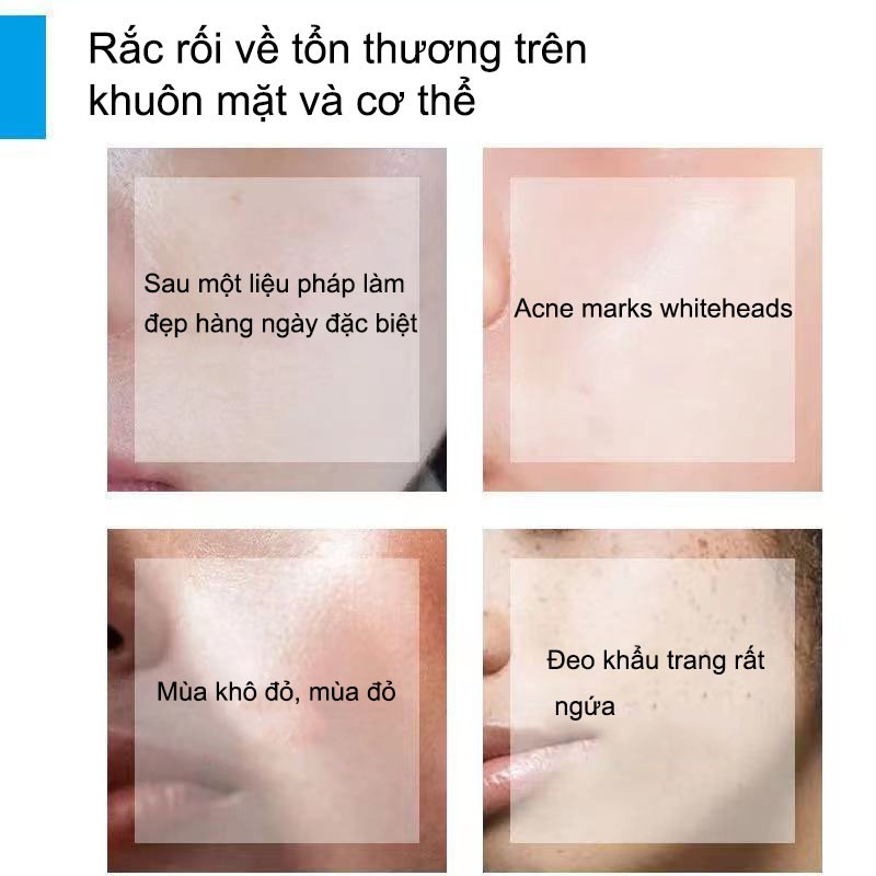Kem dưỡng làm dịu và phục hồi làn da La roche Posay Cicaplast Baume B5 40ml