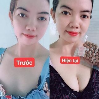 Set 5 kẹo mầm nở ngực lúa mạch gold