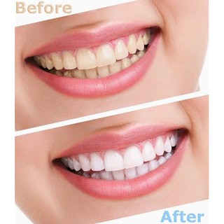 Kem Đánh Răng Crest 3D White Radiant Mint 116g Mỹ
