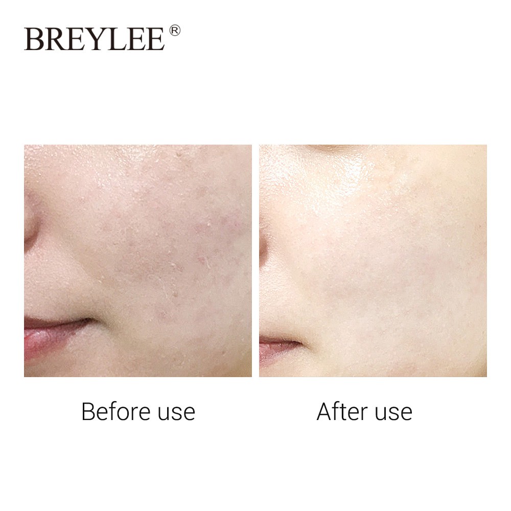 BREYLEE HA Face Mask Facial Moisturizing 1Piece | BigBuy360 - bigbuy360.vn