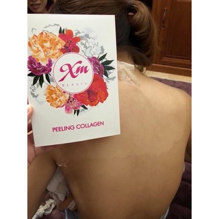 PEEL DA BODY ( THAY DA SINH HỌC )