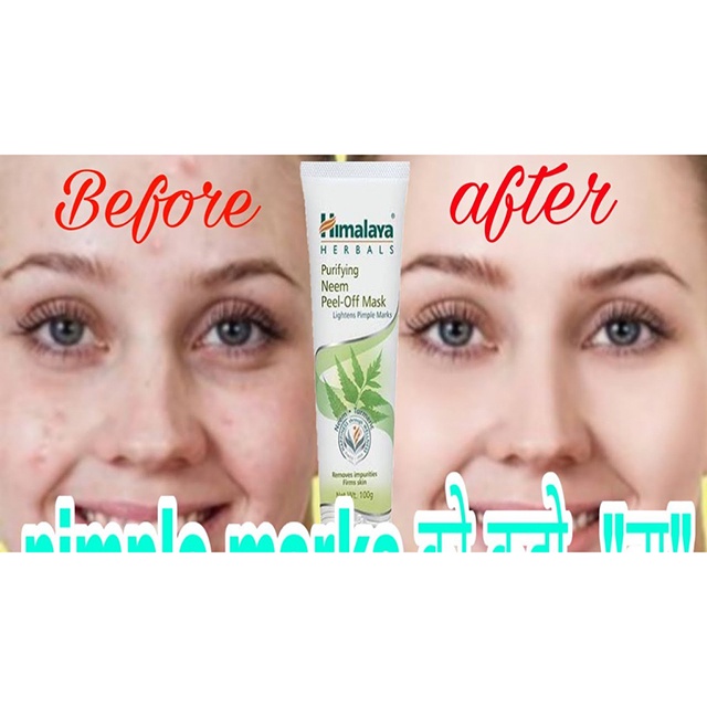 Mặt Nạ Sạch Mụn Giảm Thâm Dạng Lột Chiết Xuất Lá Neem Himalaya Purifying Neem Peel-off Mask 100g